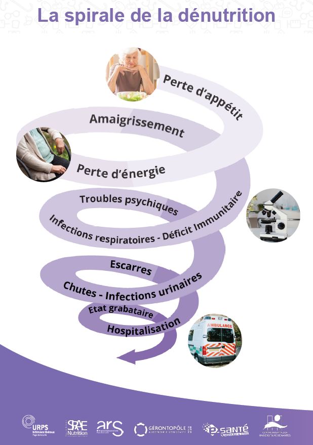 spirale-denutrition.JPG